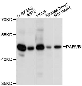 Polyclonal Rabbit anti-Human PARVB Antibody (WB)