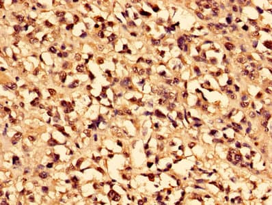 CA1 / Carbonic Anhydrase I Antibody