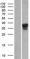 MAGIX Protein (Over-Expression Lysate Myc-DDK (Flag))