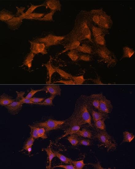 MAP2K3 / MEK3 / MKK3 Antibody