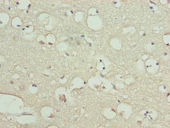 KIAA0319L Antibody