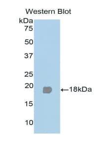 PPARG / PPAR Gamma Antibody (aa349-488)