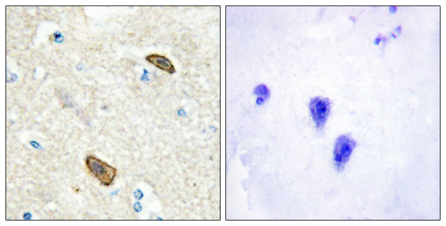 Polyclonal Rabbit anti-Human TEM7 Antibody (aa71-120, IHC)