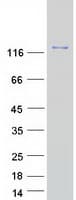 Human NOS3 / eNOS Protein (Recombinant Myc-DDK (Flag))
