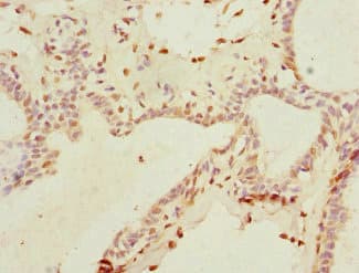 Polyclonal Rabbit anti-Human THRSP Antibody (IHC, WB)