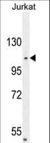 CENPC / CENP-C Antibody (aa441-467)