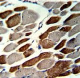 EMILIN1 / EMI Antibody (aa84-112)