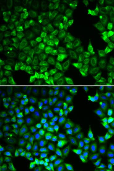 Polyclonal Rabbit anti-Human PDLIM5 / LIM Antibody (IHC, IF, WB)