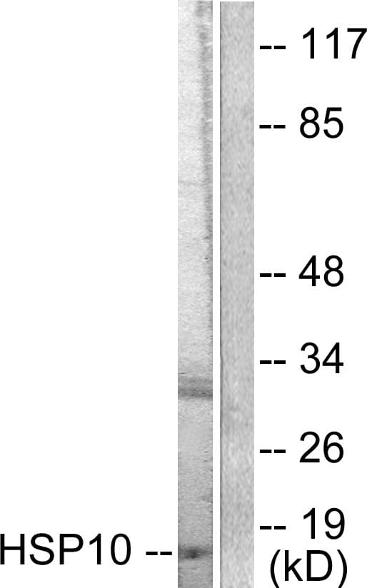 IHC-plus™ HSPE1 / HSP10 / Chaperonin 10 Antibody (aa51-100)