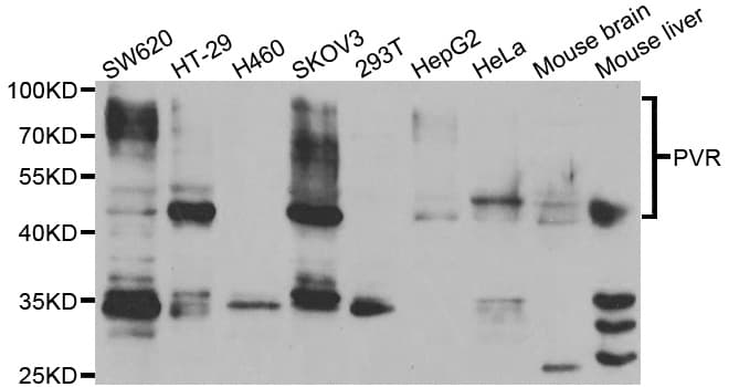 IHC-plus™ PVR / CD155 Antibody