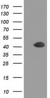 DCX / Doublecortin Antibody (clone OTI4A3)
