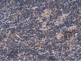 OGFOD1 Antibody (clone OTI1F4, Carrier-free)