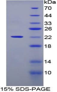 Human CLEC4M / L-SIGN / CD299 Protein (Recombinant His-T7)