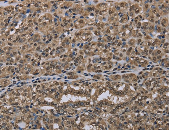 NALP6 / NLRP6 Antibody