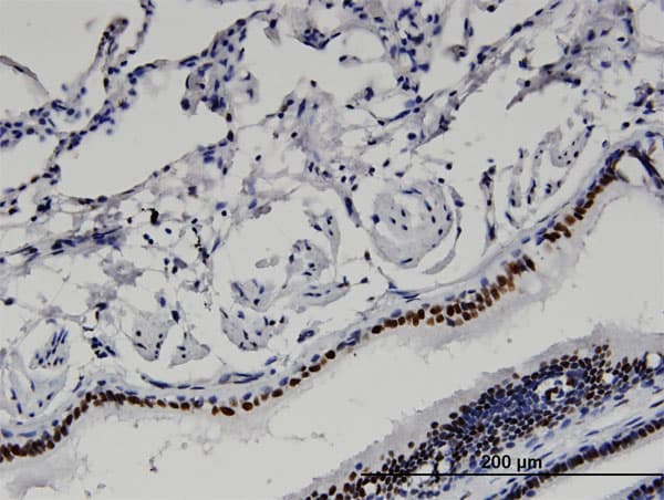 BAZ2B Antibody (clone 2D10)