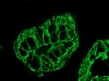 IHC-plus™ KRT20 / CK20 / Cytokeratin 20 Antibody (clone MKs20-8)