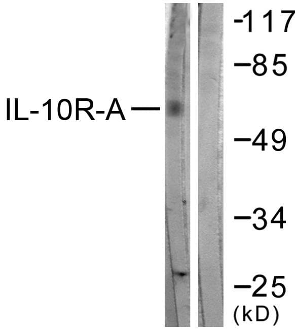 IL10RA Antibody (p496)