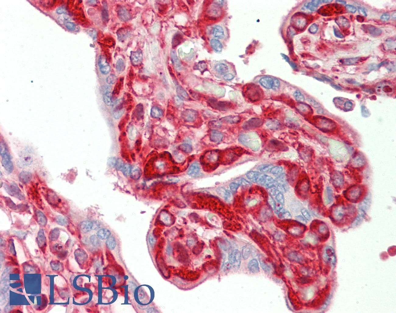 IHC-plus™ Monoclonal Mouse anti-Human TFG Antibody (clone TFG-03, IHC, WB)