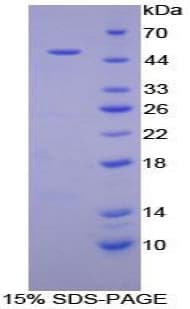 Human ACE / CD143 Protein (Recombinant His-GST)