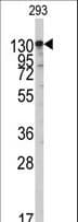 Polyclonal Rabbit anti-Human IARS2 Antibody (aa600-628, IHC, WB)
