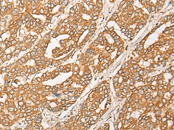 GNB1L / FKSG1 Antibody