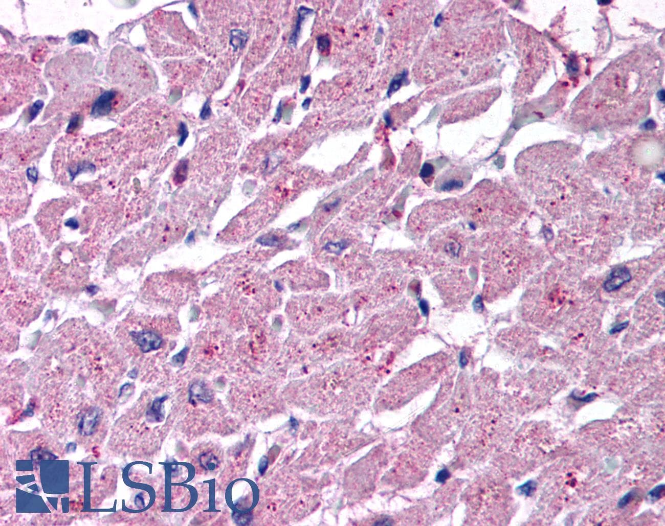 IHC-plus™ Polyclonal Rabbit anti-Human CYSLT2 / CYSLTR2 Antibody (Extracellular Domain, IHC)