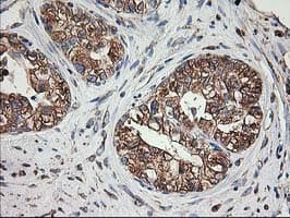 Monoclonal Mouse anti-Human TUBB4 / Tubulin Beta 4 Antibody (clone 6C2, Carrier-free, IHC, IF, WB)