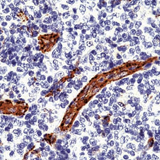 Monoclonal Mouse anti-Human PECAM-1 / CD31 Antibody (clone JC/70A, IHC)