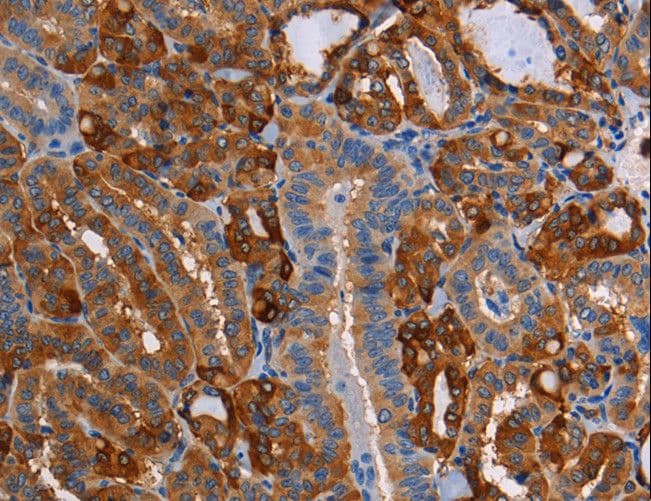 CRYAB / Alpha B Crystallin Antibody