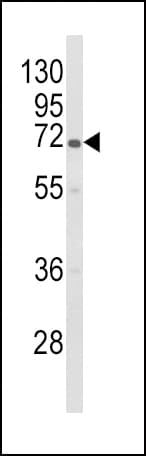 GBE1 Antibody (aa527-556)
