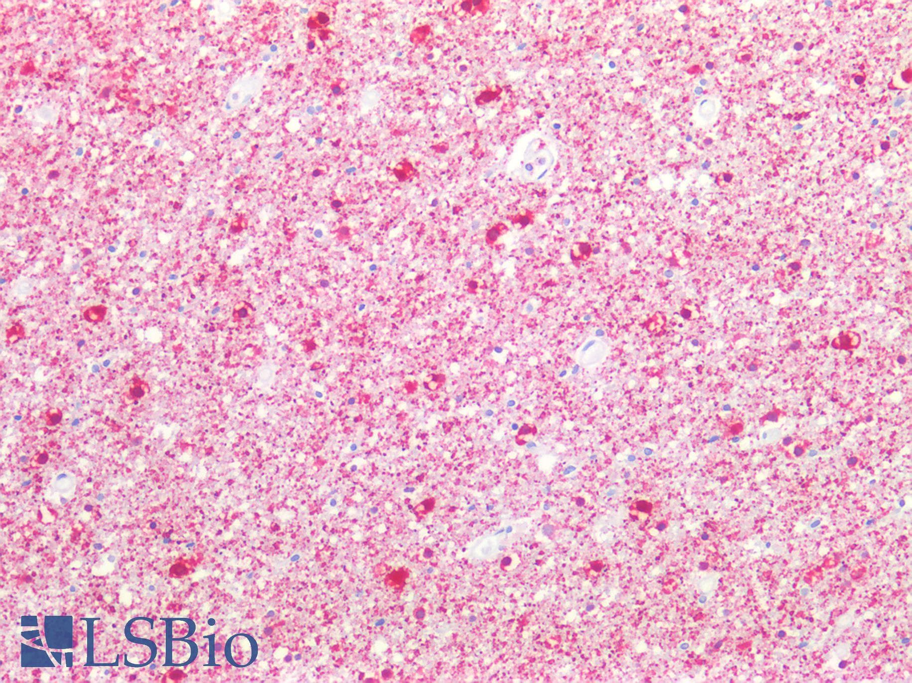 PathPlus™ STMN1 / Stathmin / LAG Antibody