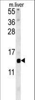 Polyclonal Rabbit anti-Human GAL / Galanin Antibody (aa73-101, IF, WB)