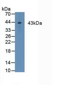 FCGR1A / CD64 Antibody (aa35-235)