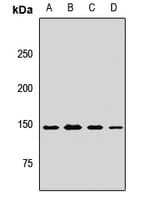 Polyclonal Rabbit anti-Human MYBBP1A Antibody (IHC, WB)