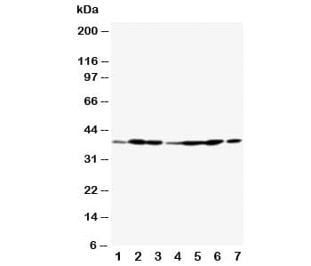 Polyclonal Rabbit anti-Human ANXA2 / Annexin A2 Antibody (aa179-199, IHC, WB)