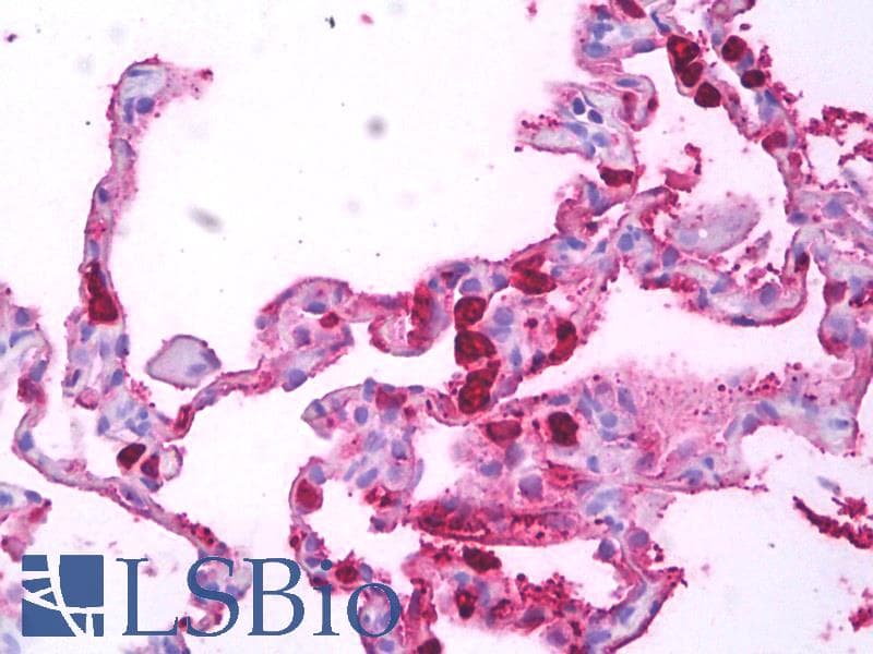 IHC-plus™ Macrophage Antibody (clone MAC387)