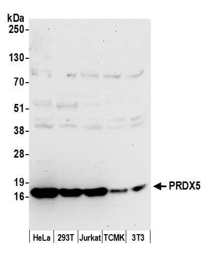 PRDX5 / Peroxiredoxin 5 Antibody (aa164-214)