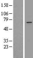 ZDHHC16 Protein (Over-Expression Lysate Myc-DDK (Flag))
