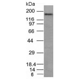 NCAM / CD56 Antibody (clone NCAM1/795)