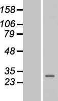 GOSR2 / Membrin Protein (Over-Expression Lysate Myc-DDK (Flag))