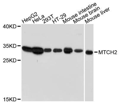 Polyclonal Rabbit anti-Human MTCH2 Antibody (WB)