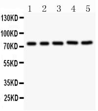 RIPK1 / RIP Antibody (aa316-671)
