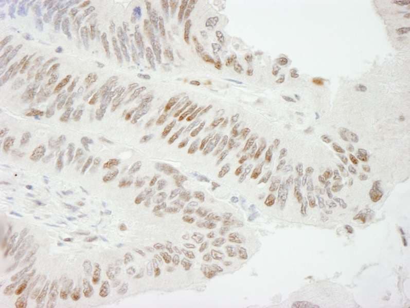 Polyclonal Rabbit anti-Human ZBTB7A / Pokemon Antibody (aa525-C-term, IHC)