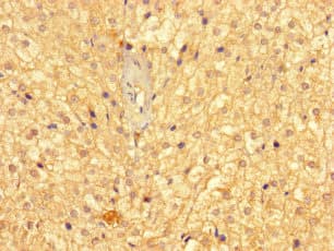 Polyclonal Rabbit anti-Human GMPPB Antibody