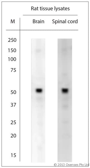 ATPASE6 / ATP6 Antibody (aa100-150)