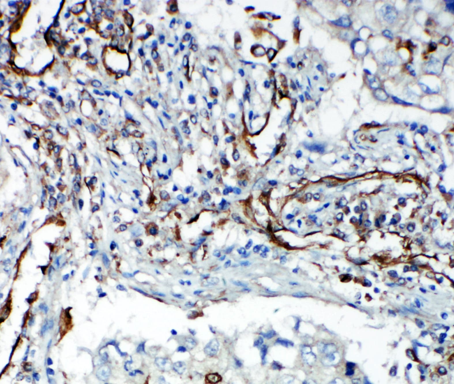KDR / VEGFR2 / FLK1 Antibody (aa454-469)