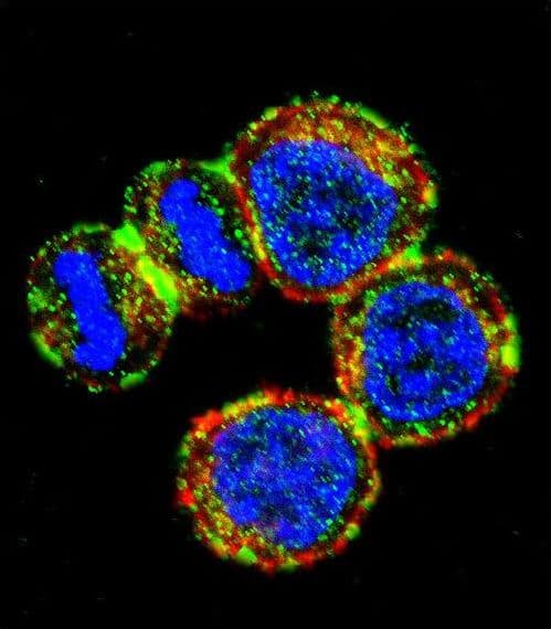 Polyclonal Rabbit anti-Human BIRC3 / cIAP2 Antibody (aa59-88, IHC, IF, WB)