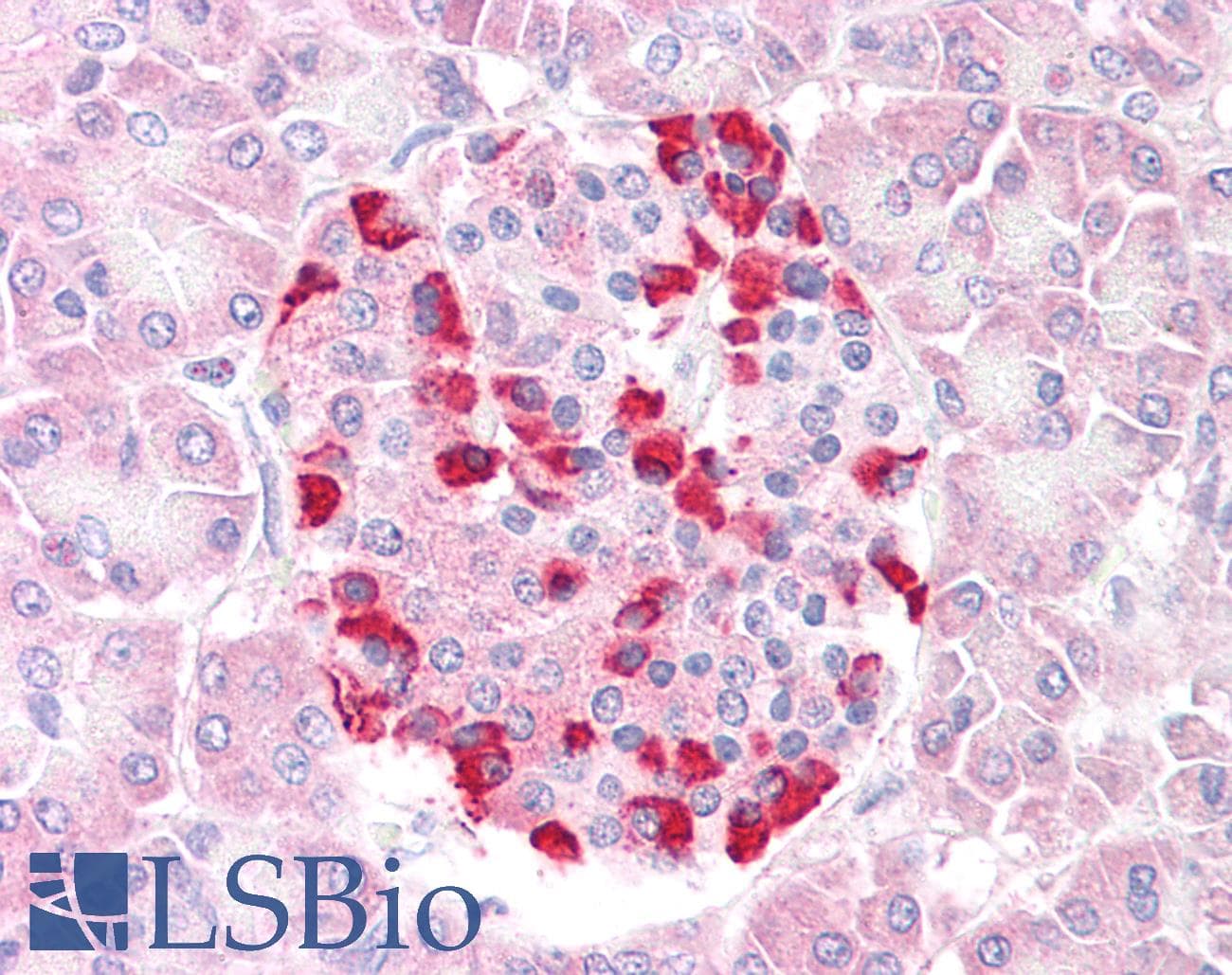 IHC-plus™ Polyclonal Goat anti-Human SOCS4 Antibody (aa426-439, IHC)