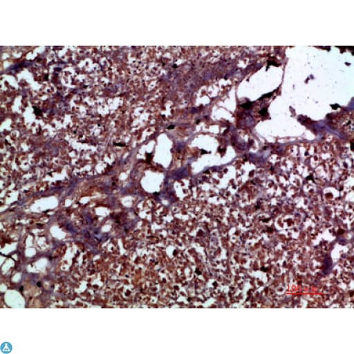 Polyclonal Rabbit anti-Human IL17C Antibody (IHC)
