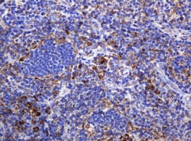 Monoclonal Mouse anti-Human POGK Antibody (clone OTI3E2, IHC, WB)
